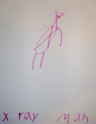 X Ray Man